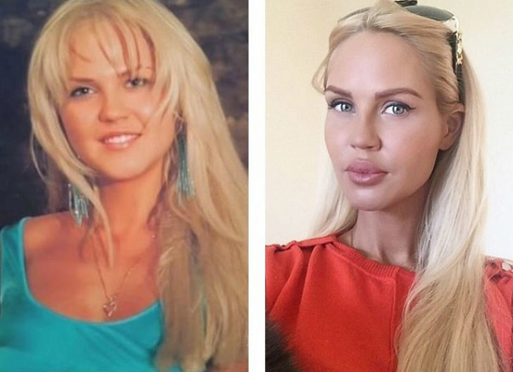 10 российских красавиц до и после пластики
