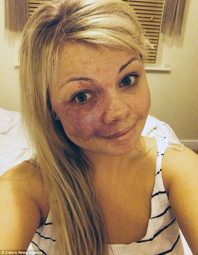 Маскировка "недостатка" на лице сделала ее экспертом по макияжу!!