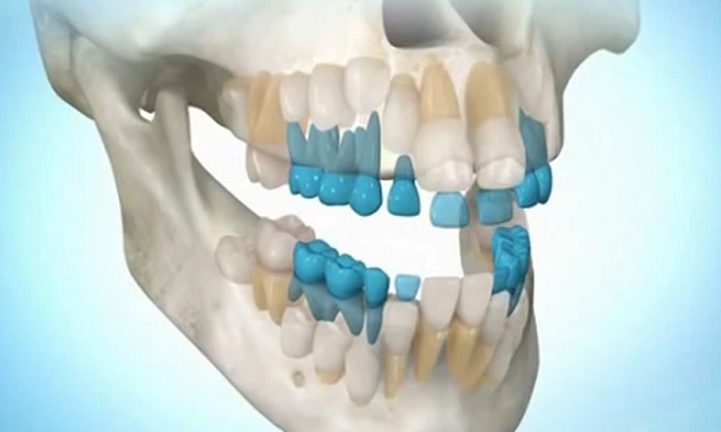 Теперь вы можете вырастить собственные зубы за 9 недель!
