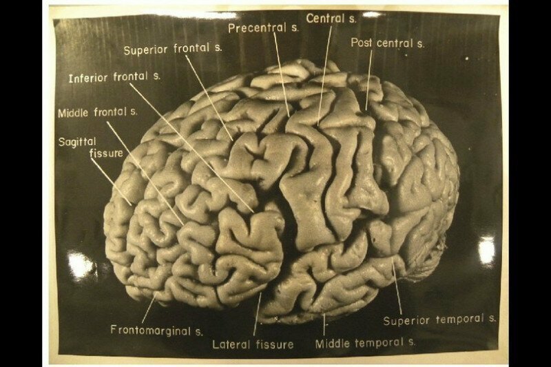 Мозг Альберта Эйнштейна, сохранённый перед кремацией, США, 1955 год.