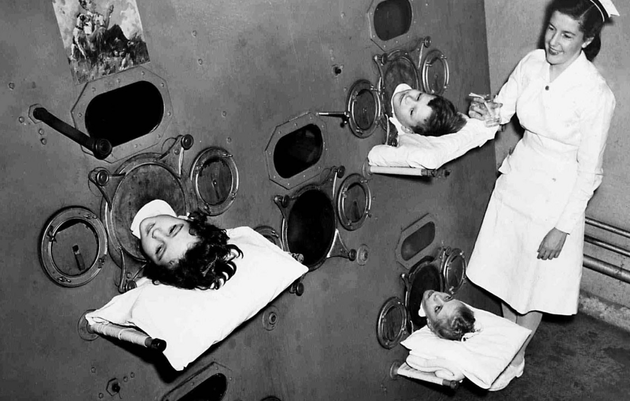 Дети в "железном легком" до вакцинации от полиомиелита, 1950 год