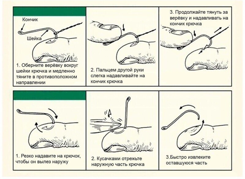 Как достать крючок из пальца