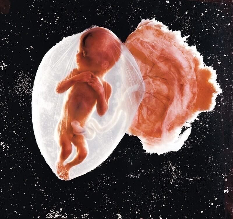 Зародыш, 18 недель