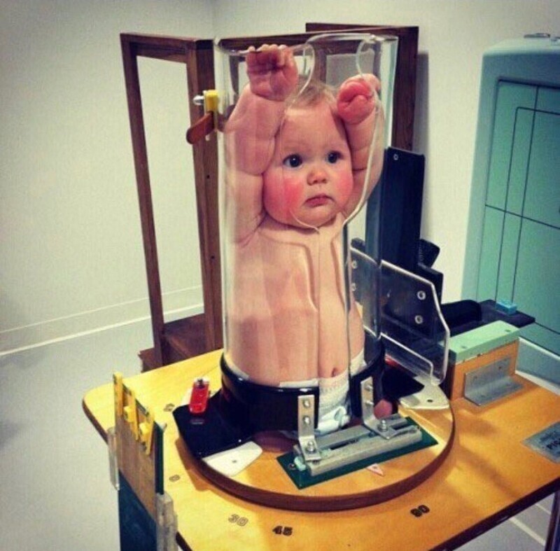 Как делают рентген младенцам