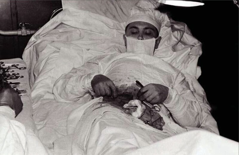 Врач советской антарктической экспедиции Леонид Рогозов проводит себе аппендэктомию, 1961 год