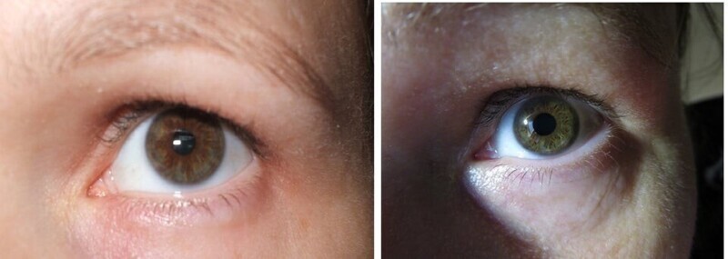 До 20 лет мои глаза были карими, а с 2008 года они совершенно изменили свой цвет