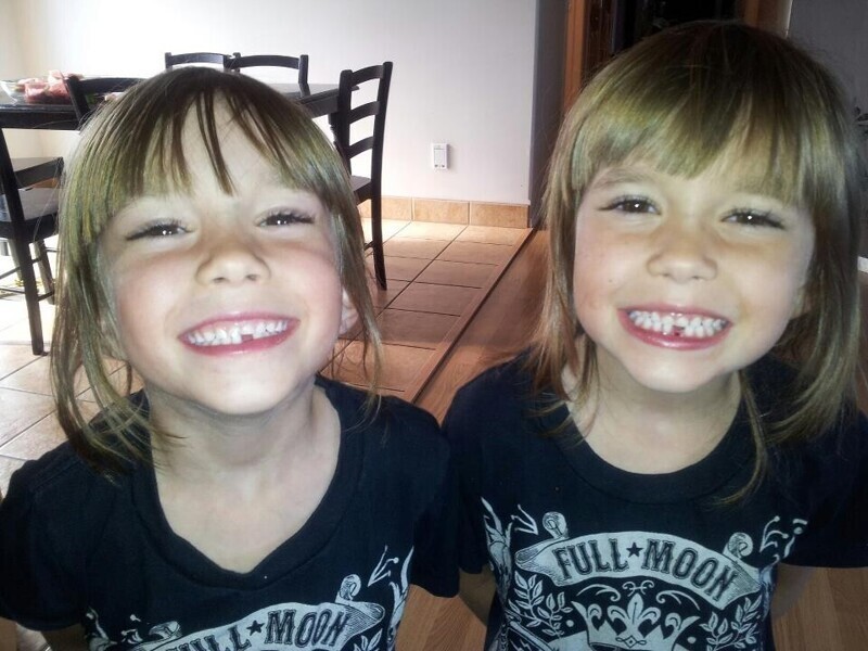 Наши дочери-близнецы потеряли один и тот же зуб с интервалом в 5 минут друг от друга