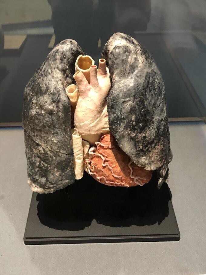 Легкие курильщика, сохранившиеся на выставке человеческого тела в Научном музее