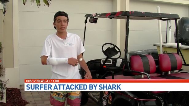 Акула напала на парня носившего браслет отпугивающий акул