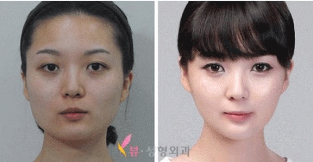 Чудеса случаются! Пластическая хирургия Южной Кореи, поражающая воображение