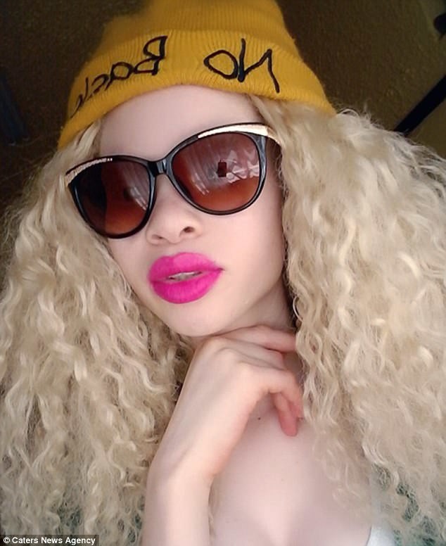 Красавица-альбинос добилась успеха в модельном бизнесе