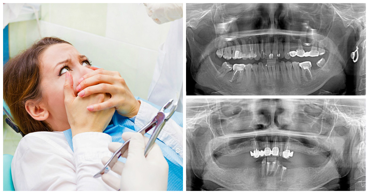 Записки стоматолога или понты дороже собственных зубов
