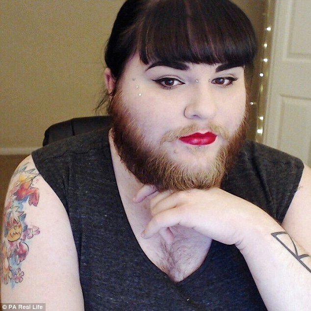 Влюбившись в модель женщина с гормональным расстройством перестала сбривать бороду