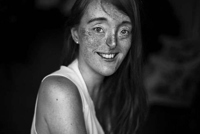 Внутренняя красота: девушка с дефектом лица поражает своими волшебными фото
