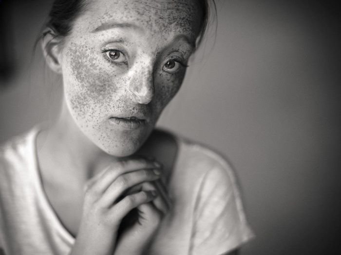 Внутренняя красота: девушка с дефектом лица поражает своими волшебными фото